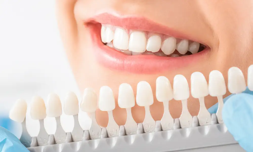 Polish dentist at Maple Mews Dental performing professional teeth whitening treatment
